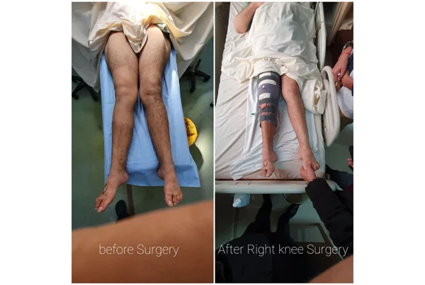 Orthopaedics