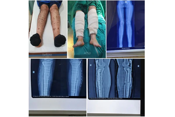 Orthopaedics
