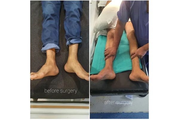 Orthopaedics