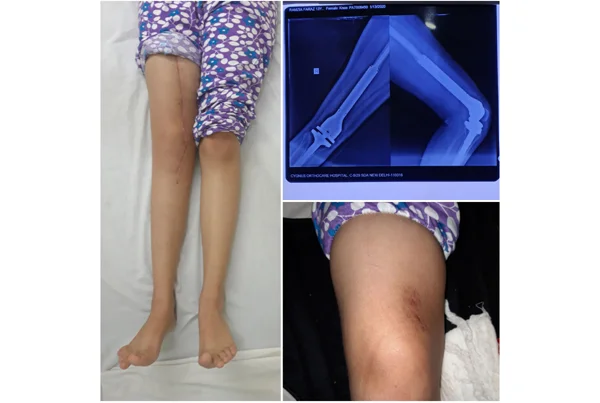 Orthopaedics