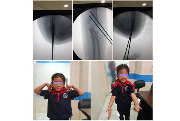Orthopaedics