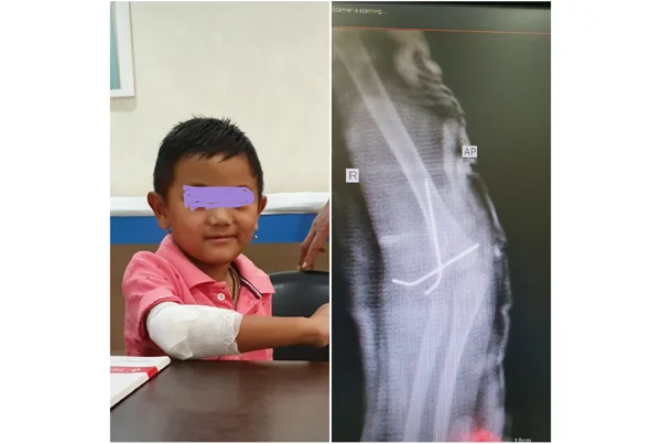 Orthopaedics