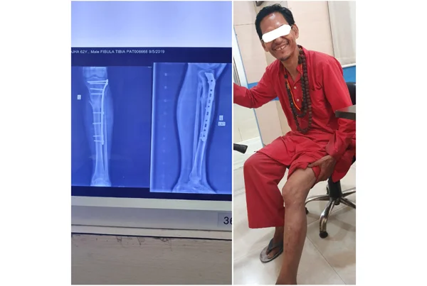 Orthopaedics