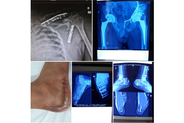 Orthopaedics