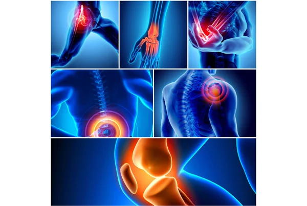 Orthopaedics