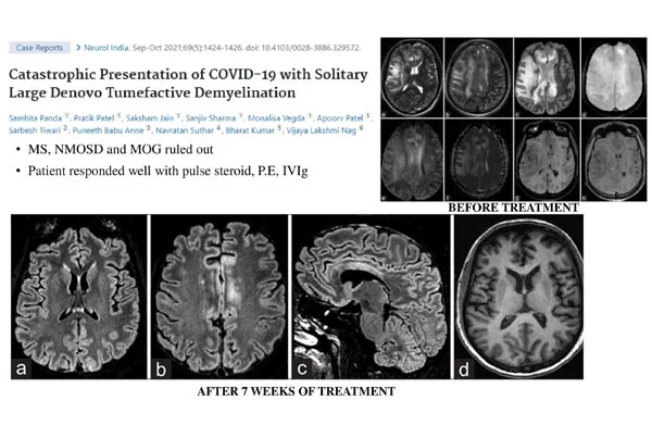 Neurology
