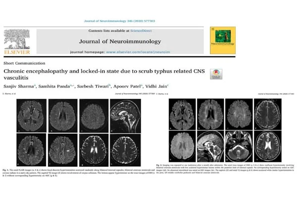 Neurology