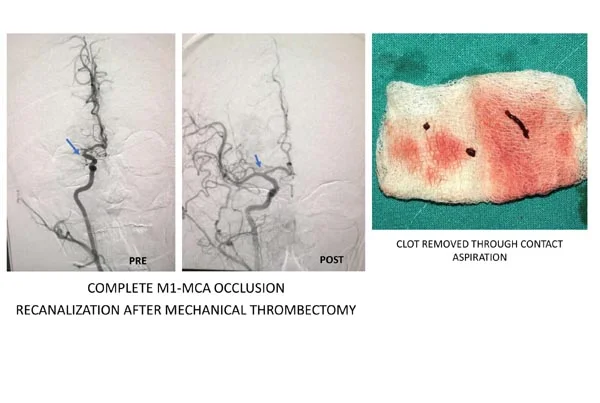 Neurology