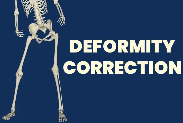 Deformity Corrections