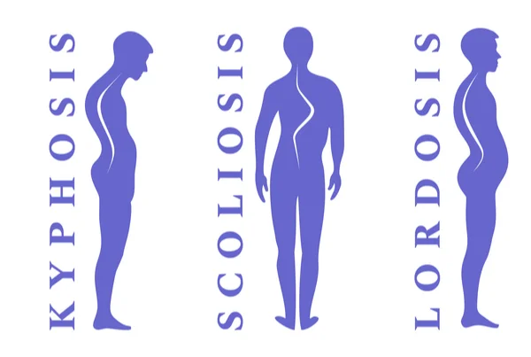 Spine Disorders